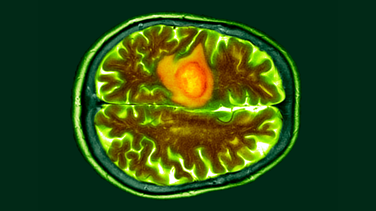 Colored CT scan of a section through a person